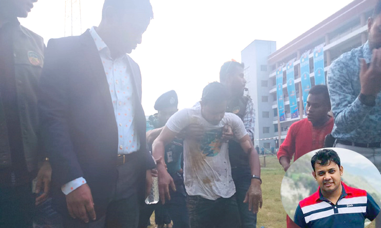 শ্বাসনালী পুড়ে গেছে, শঙ্কামুক্ত নন কৌতুক অভিনেতা রনি