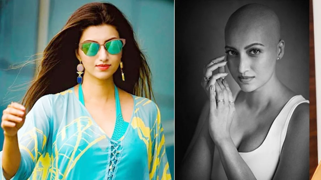 ভয়ঙ্কর রোগে বদলে গেছে অভিনেত্রীর চেনা রূপ!
