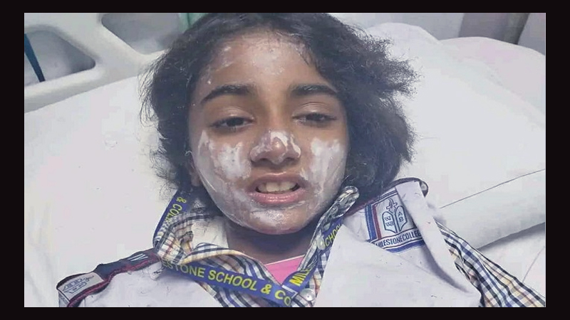 অর্ধেক ঠিকানা ছাড়া কিছুই বলতে পারছে না আহত ছোট্ট রাফিয়া