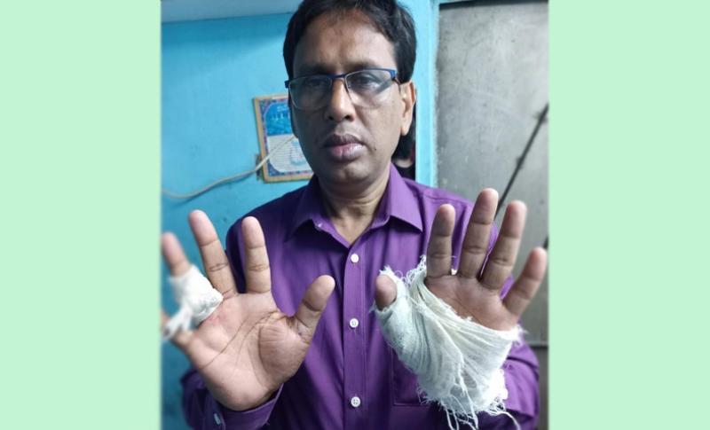জেল থেকে বের হয়ে শিক্ষা কর্মকর্তাকে প্রকাশ্যে হাতুড়িপেটা
