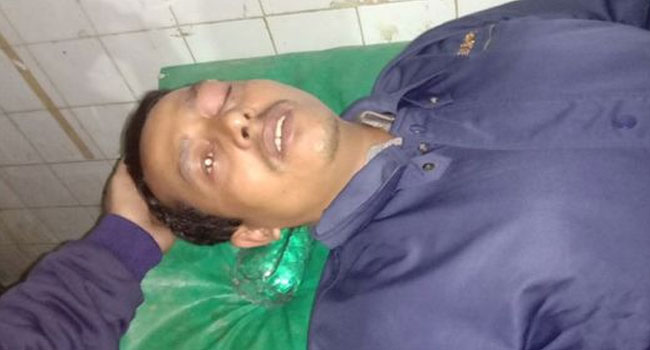 ব্যাডমিন্টন মাঠের অবৈধ বিদ্যুৎ সংযোগ কেটে দেয়ায় পিটিয়ে হাসপাতালে